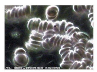 Analiza QHRS Biopiramide: 4.4. Tabelarni prikaz mernih podataka potrebne količine krvi