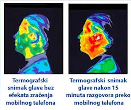 Da li je mobilni telefon štetan po zdravlje